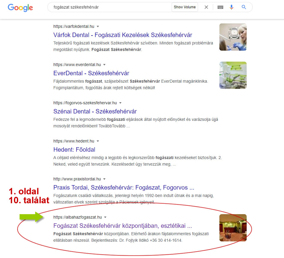 keresőoptimalizálás fogászat Székesfehérvár Google első oldal tizedik hely