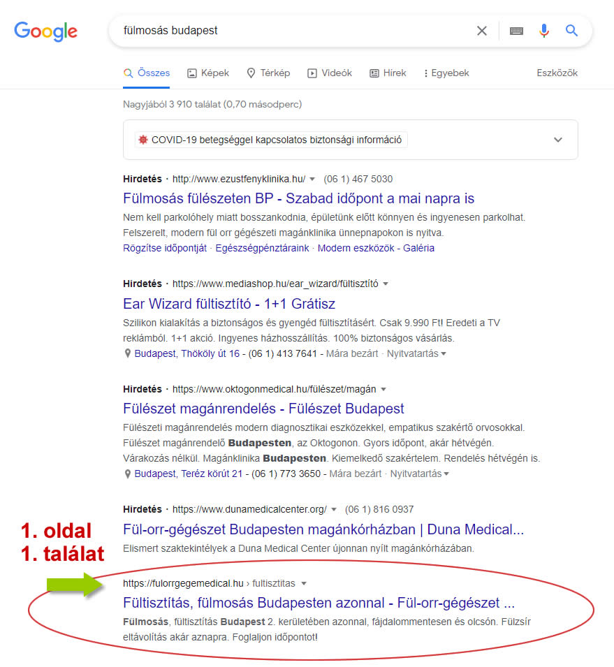 Keresőoptimalizálás fülmosás Budapest Google első oldal első találat